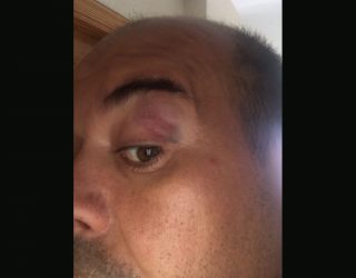 Un árbitro de Colombicultura denuncia por agresión al alcalde de Alcadozo y a su hijo