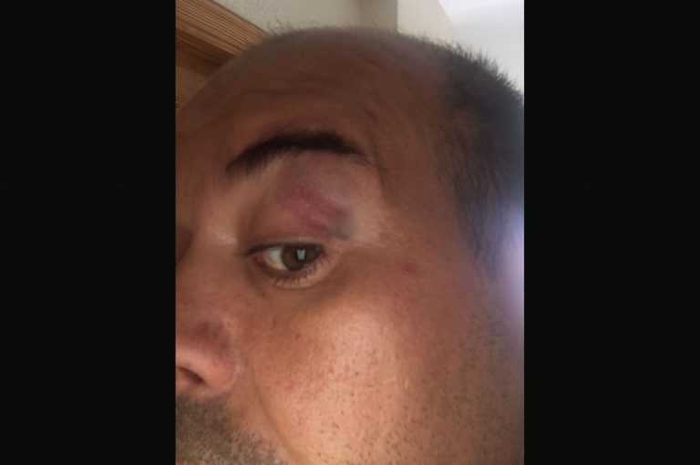 Un árbitro de Colombicultura denuncia por agresión al alcalde de Alcadozo y a su hijo